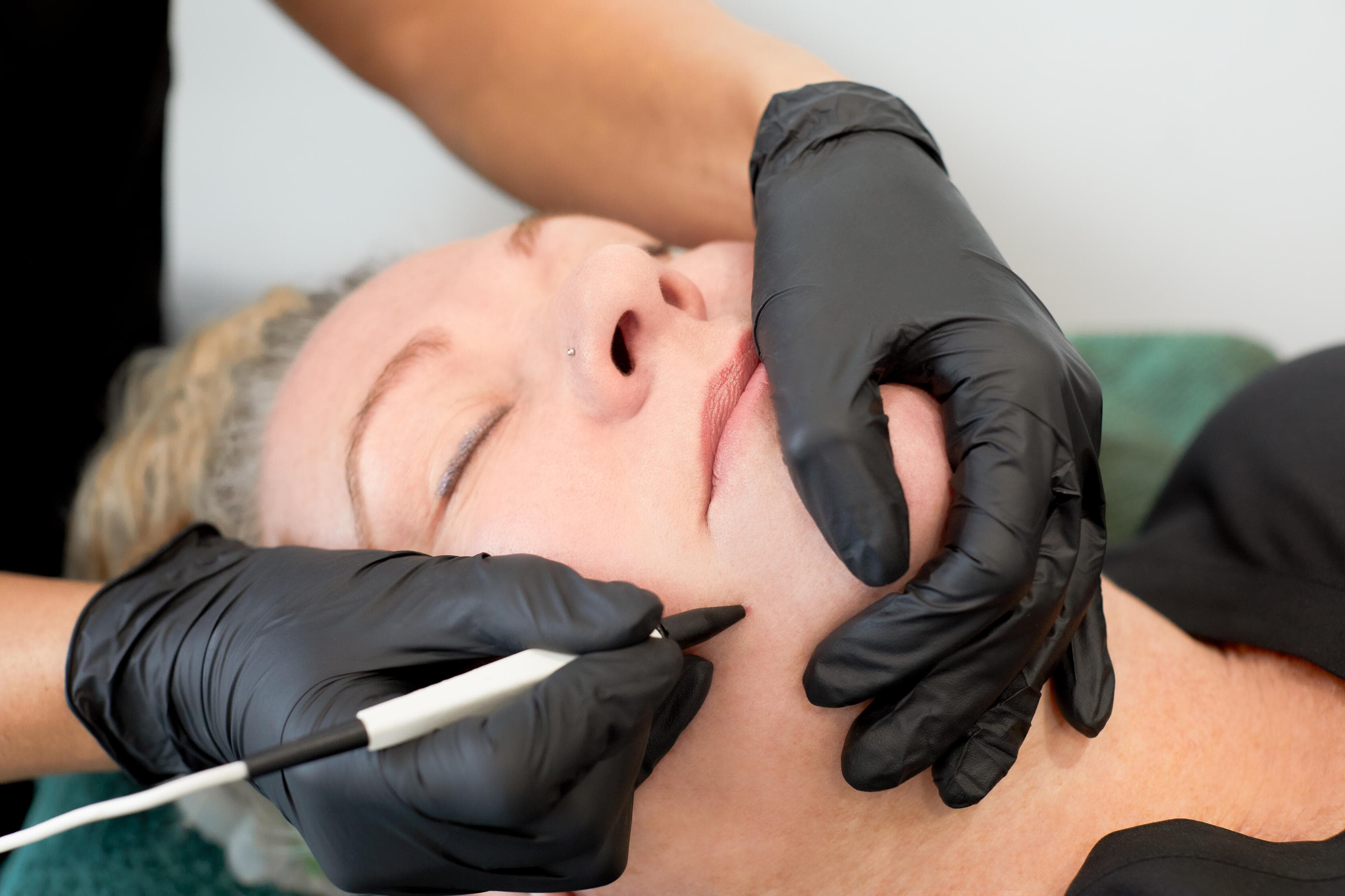 image of Advanced Skincare treatment