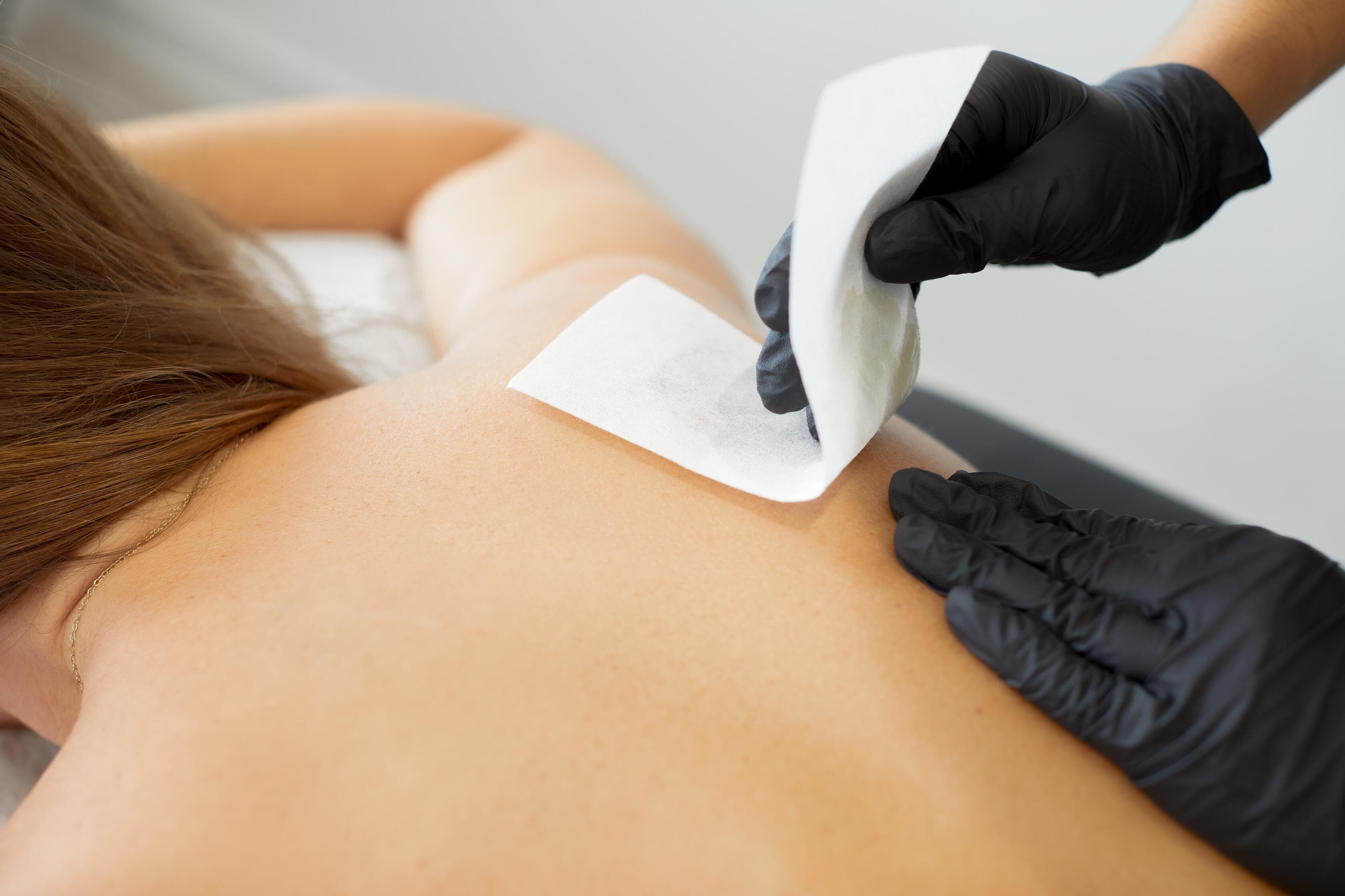 image of Hair Removal treatment