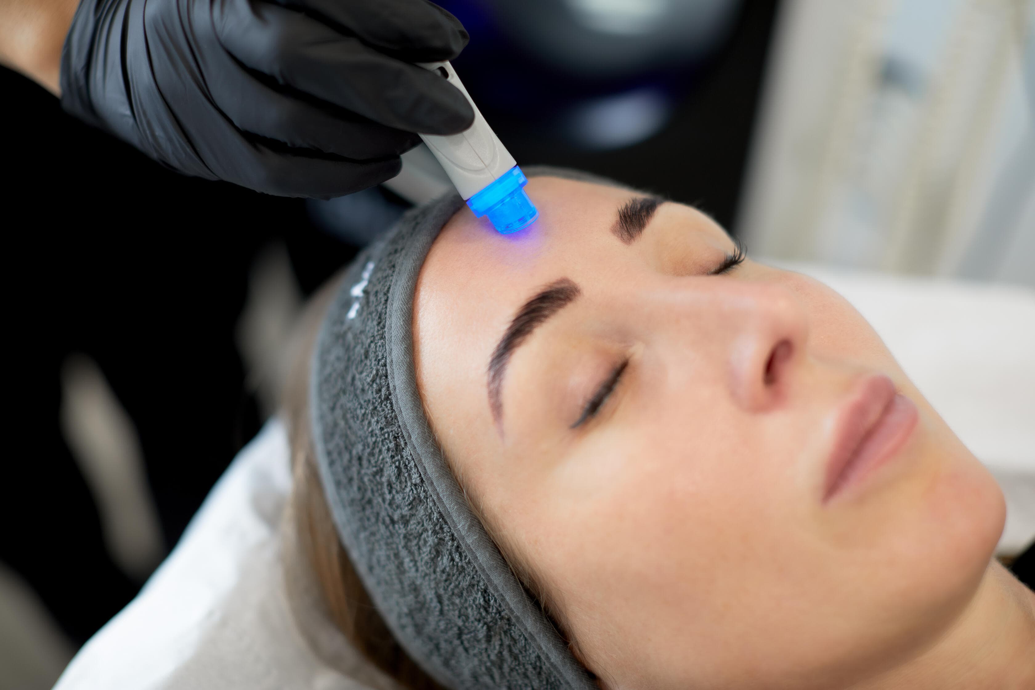 image of Hydrofacial treatment