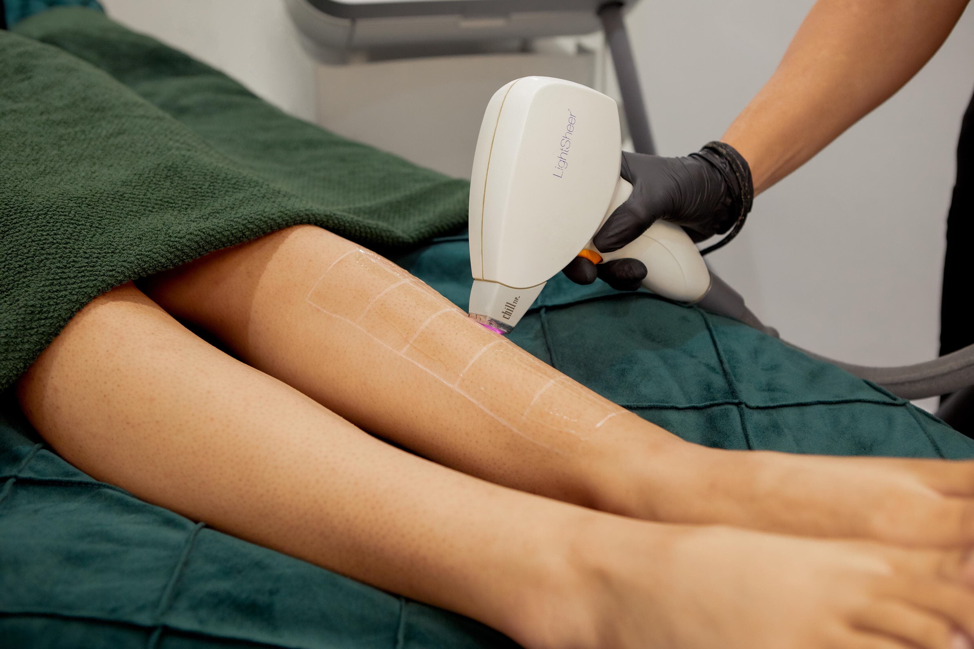 image of Full Leg Hair Laser Hair Removal treatment