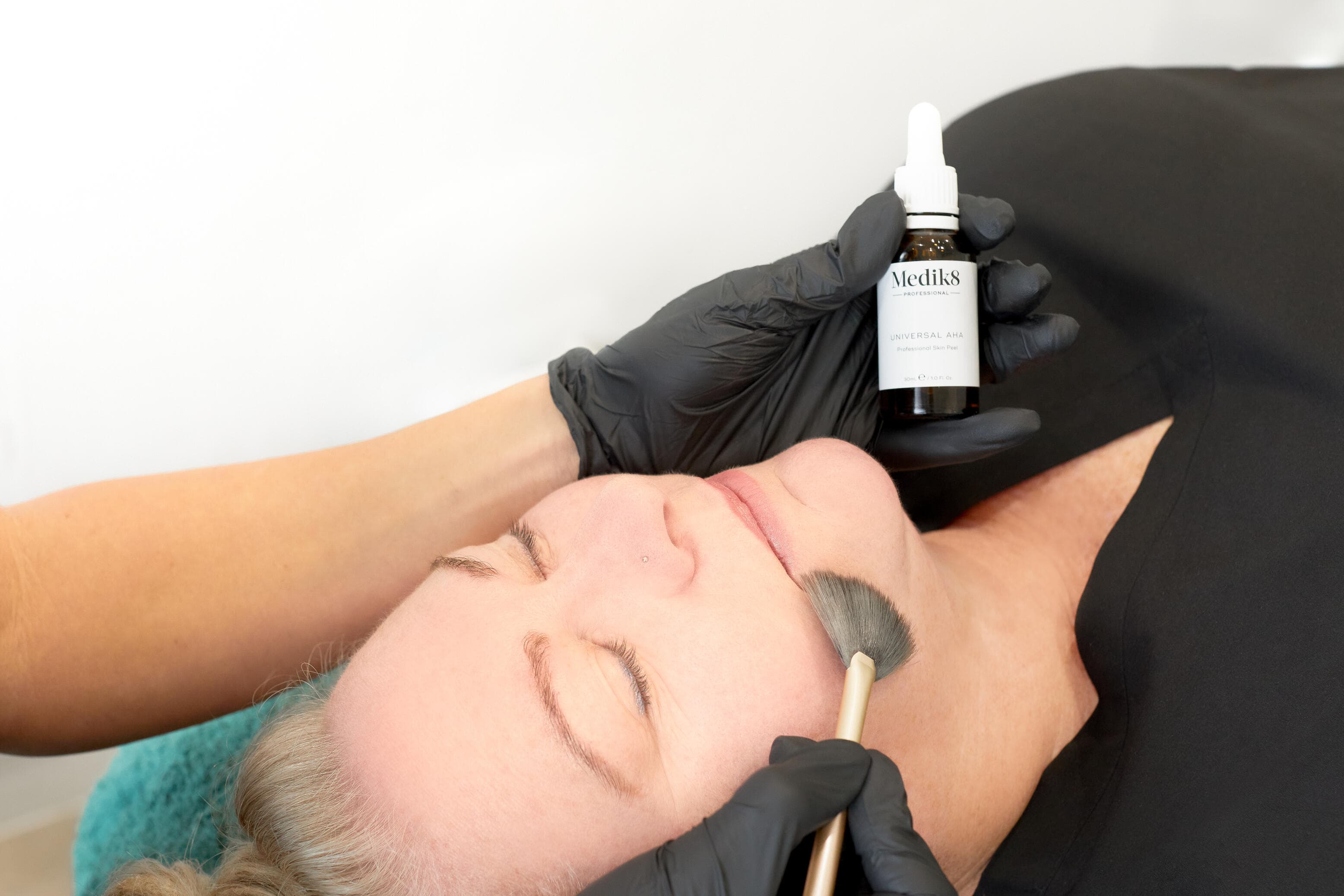 image of Skin Peels treatment