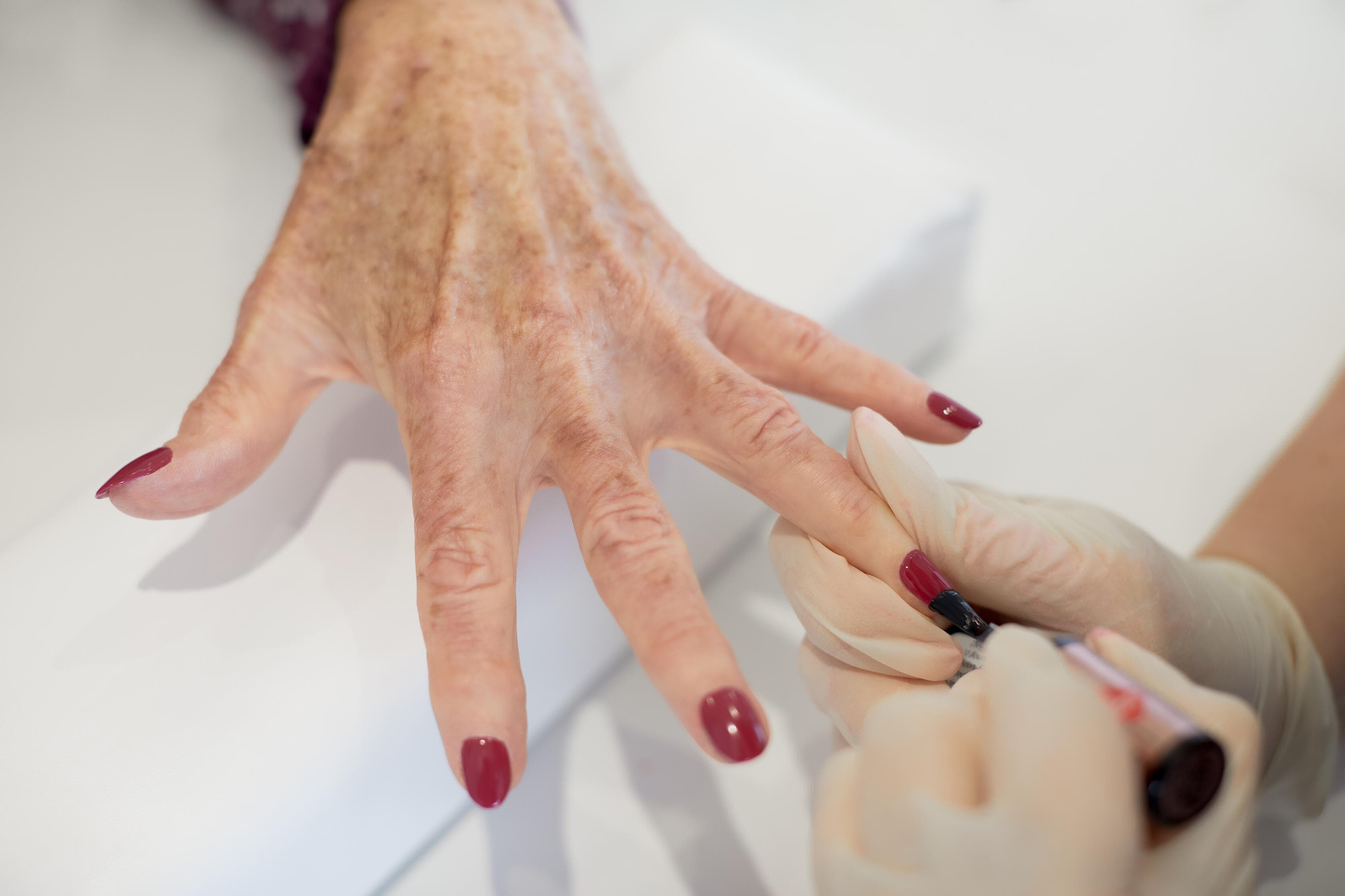 image of Acrylic Nails treatment