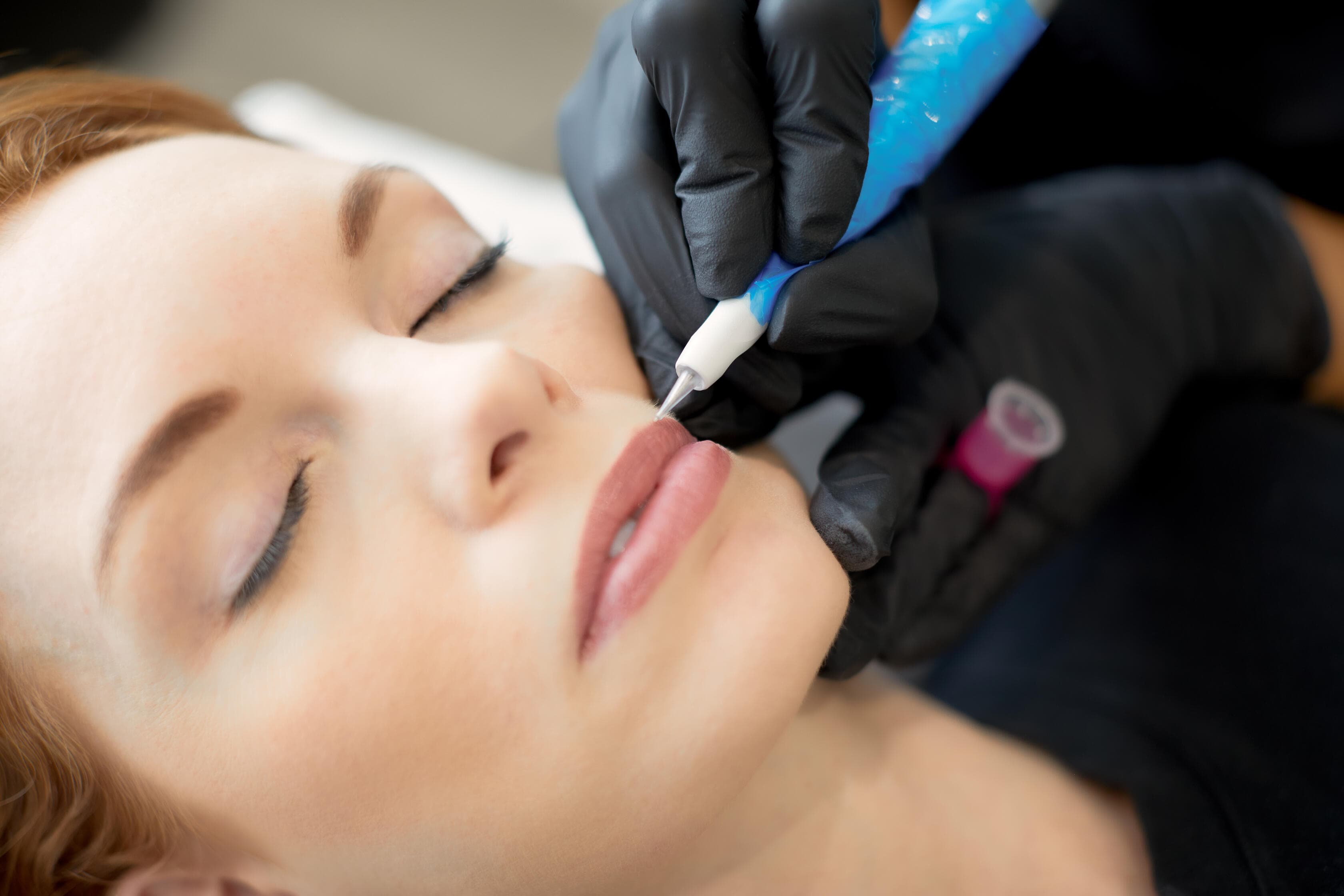 image of Semi-Permanent Beauty Spot treatment